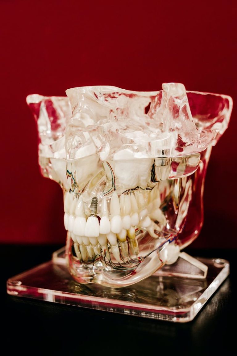 Co warto wiedzieć o implantach i protezach zębów?